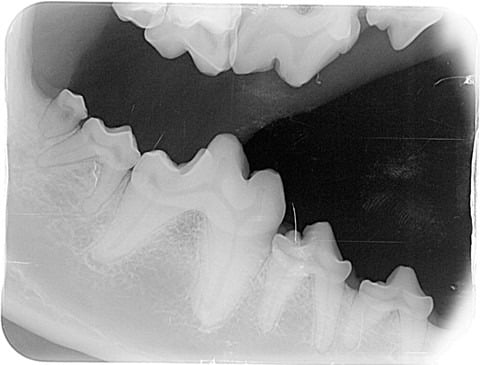 Dental X-ray